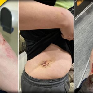 Journalist Andy Ngo Brutally Attacked in Portland by Antifa - He Needs Prayers NOW