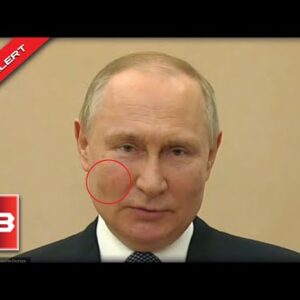 People Noticed That Putin Had Dark Splotches On His Cheeks, Here’s What It Could Be