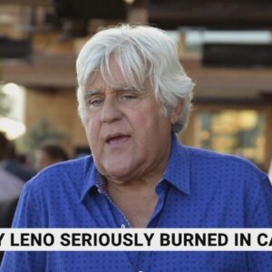 Jay Leno seriously burnt after car fire
